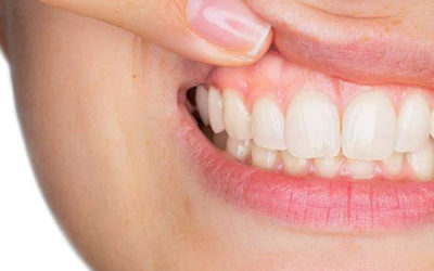 7 Tips to Prevent Gum Disease